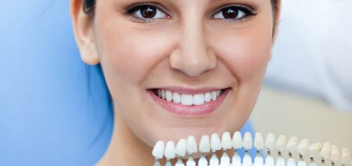 Bleaching - Dr. med. Wittken