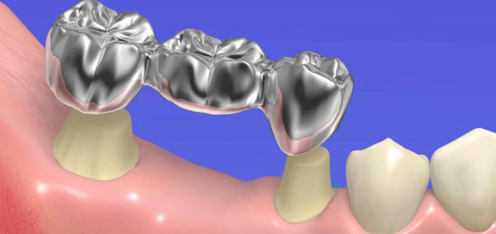 Zahnarzt Dr. Wittken