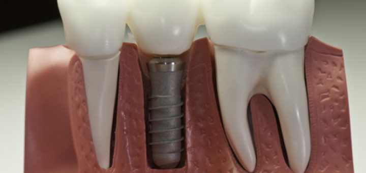 Zahnarzt-München-Pasing