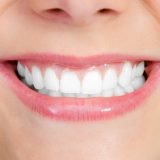 professionelle Zahnreinigung