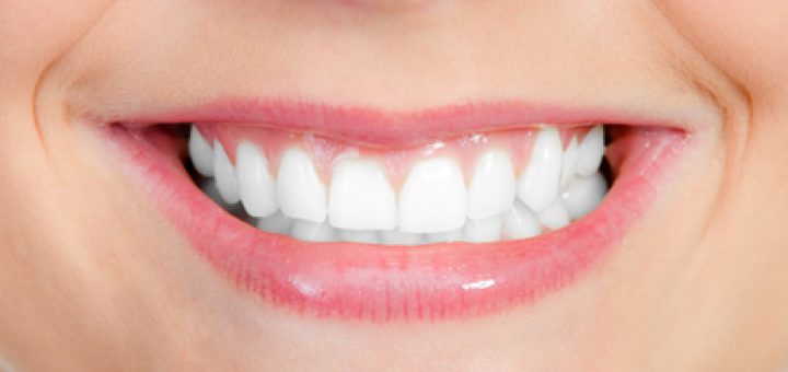 professionelle Zahnreinigung